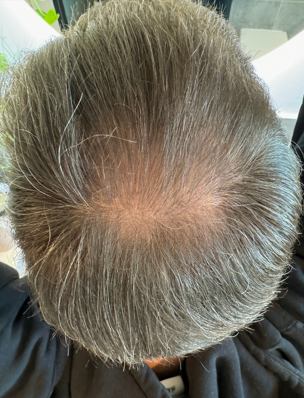 Tim P. nach drei Monaten mit ribogrow®