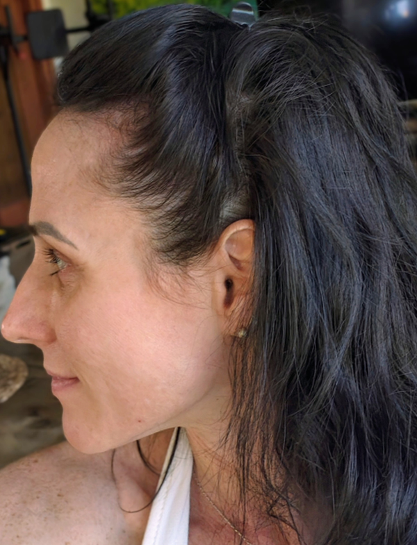 Carina H. nach einem Jahr mit ribogrow®: dichteres Haar an den Schläfen und am Haaransatz