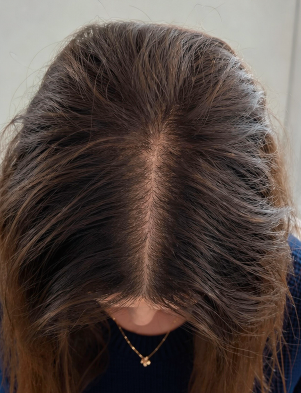 Miriam W. nachher, mit ribogrow®