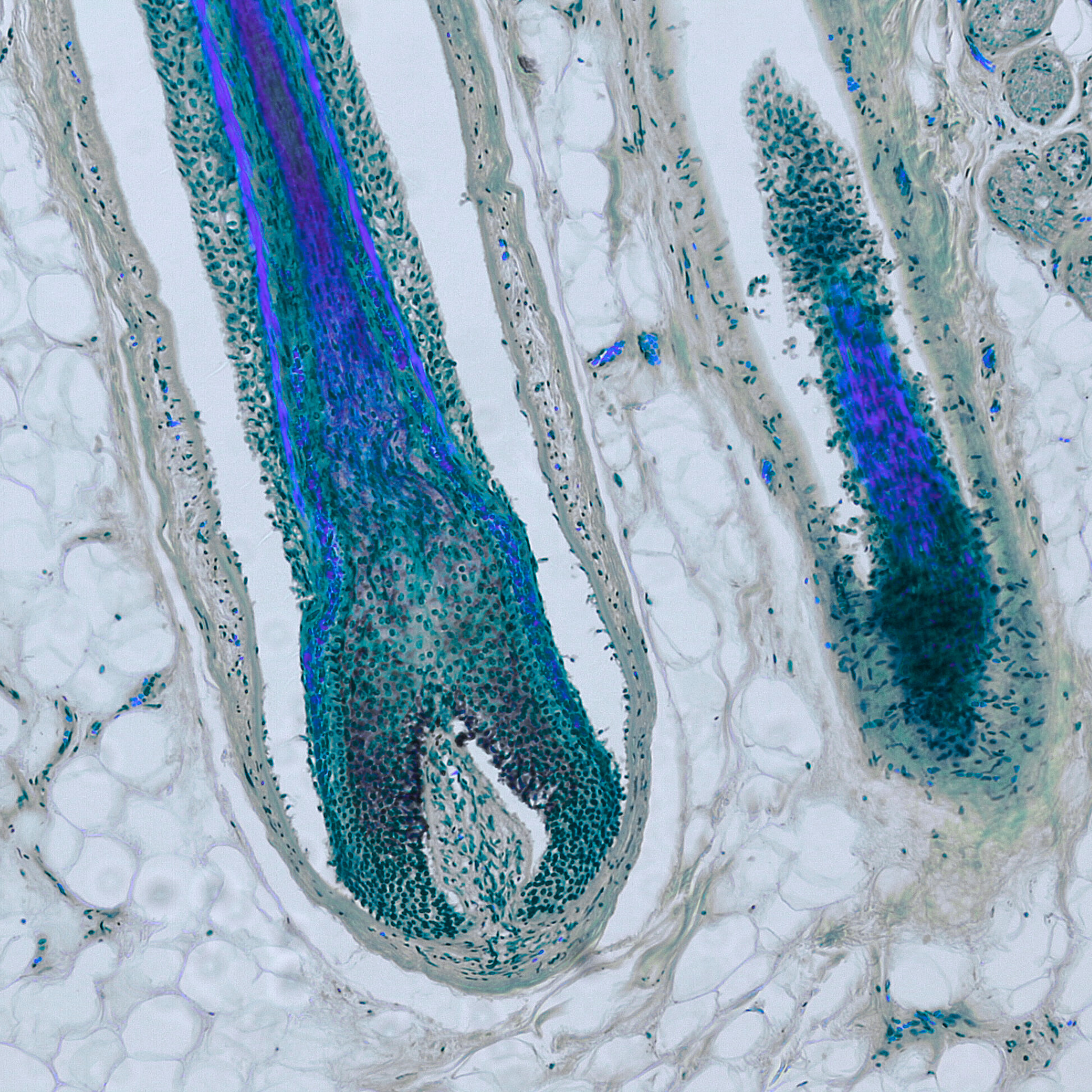 Mikroskopaufnahme eines menschlichen Haarfollikels nach der ribogrow Behandlung mit Zellstrukturen, dargestellt zur Untersuchung von Haarwachstum, Haarwurzel und Kopfhautgesundheit.