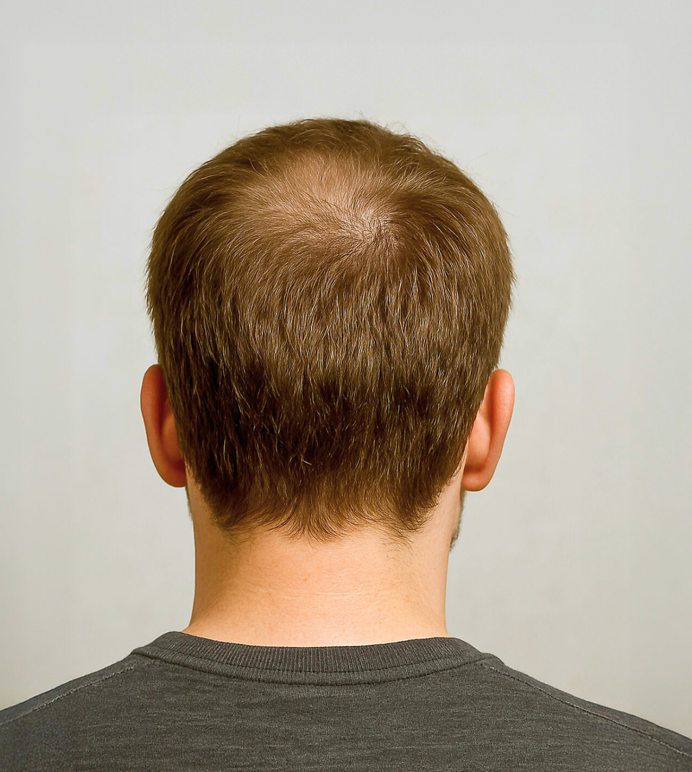 Before Image